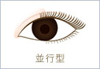 並行型
