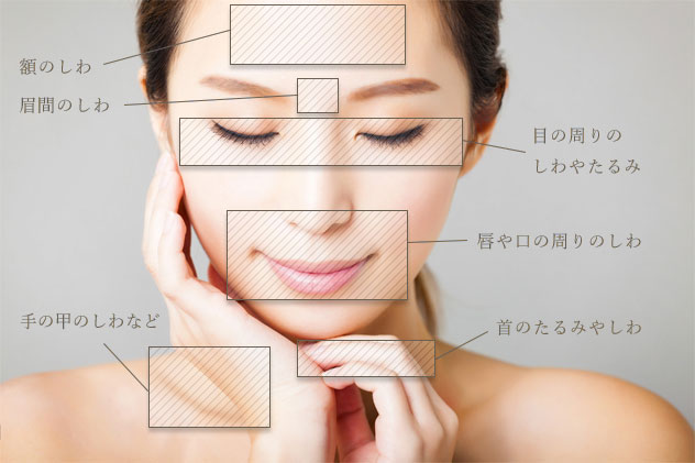 W-PRP皮膚再生療法の適応部位